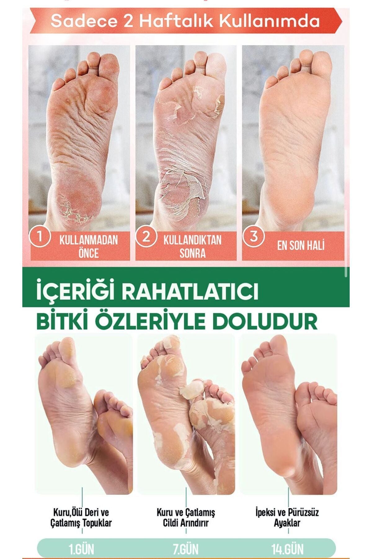 Dermatox Wonder Foot Ayak Peeling Maskesi Ölü Deri ve Çatlaklara Karşı Etkili Bakım (50ml)